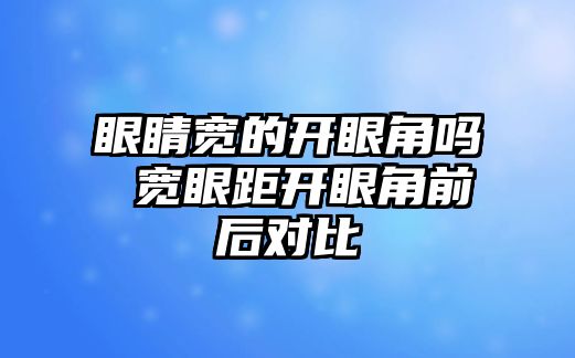 眼睛寬的開眼角嗎 寬眼距開眼角前后對比