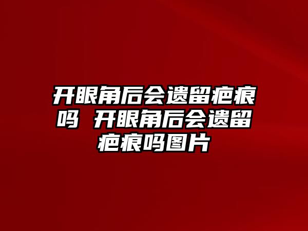 開眼角后會(huì)遺留疤痕嗎 開眼角后會(huì)遺留疤痕嗎圖片