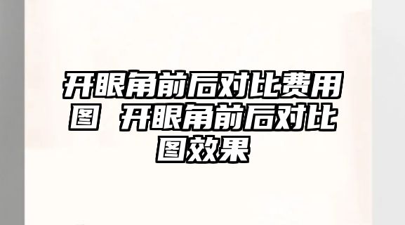 開眼角前后對(duì)比費(fèi)用圖 開眼角前后對(duì)比圖效果