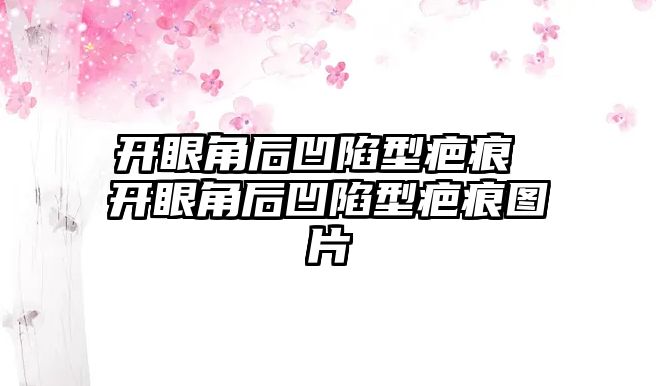 開眼角后凹陷型疤痕 開眼角后凹陷型疤痕圖片